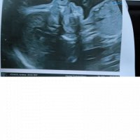 Andrea cherche une nounou à Nemours